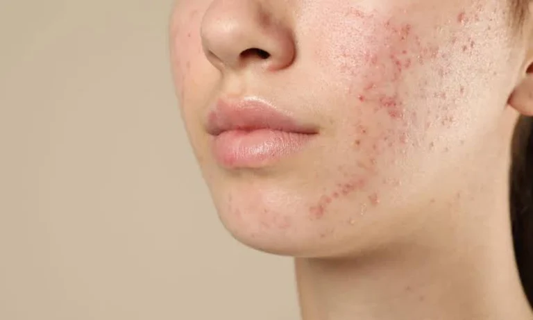 The Connection between Alcohol and Skin Health
